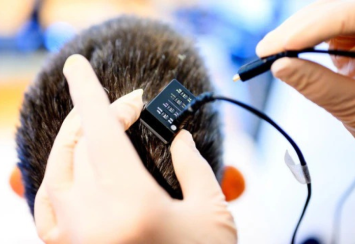 Mind Speaks Again: A Groundbreaking Leap in Real-Time Speech for the Silent"