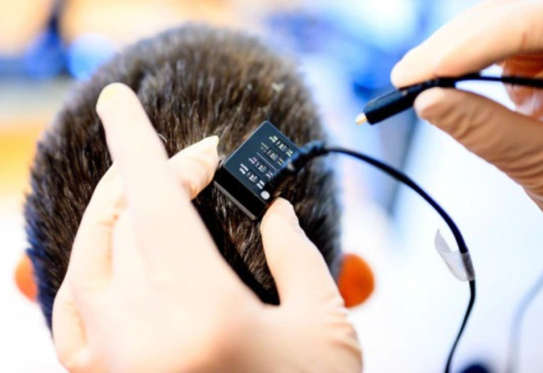 Mind Speaks Again: A Groundbreaking Leap in Real-Time Speech for the Silent"