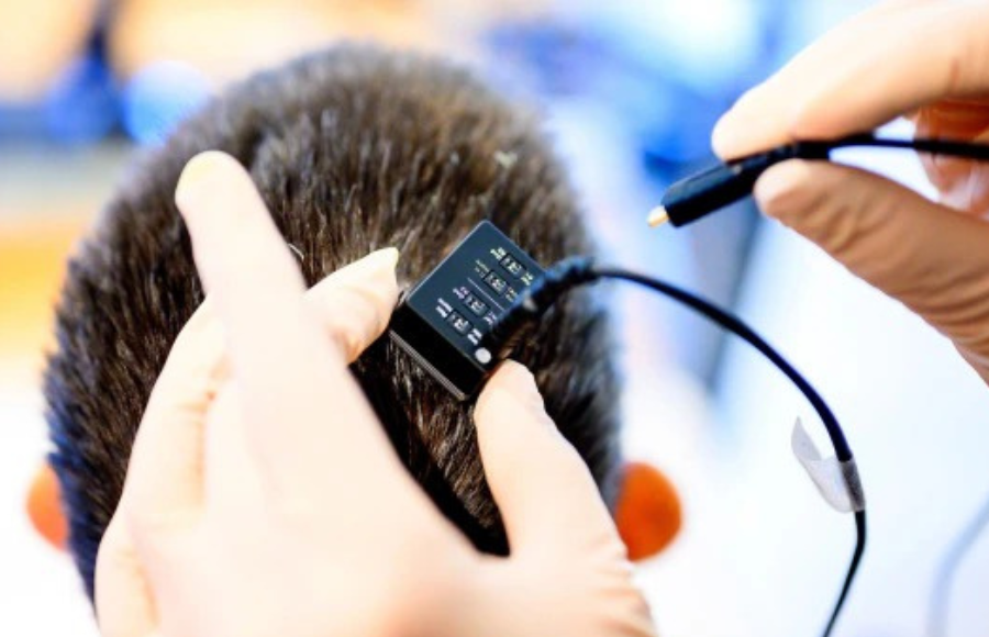 Mind Speaks Again: A Groundbreaking Leap in Real-Time Speech for the Silent